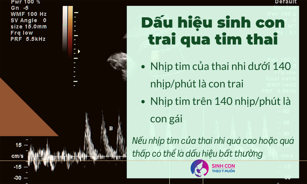 dấu hiệu sinh con trai dựa vào tim thai