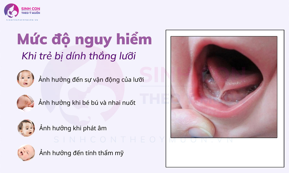 Trẻ bị dính thắng lưỡi có nguy hiểm không