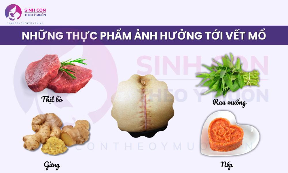 Những thực phẩm ảnh hưởng tới vết mổ mẹ tuyệt đối không nên ăn