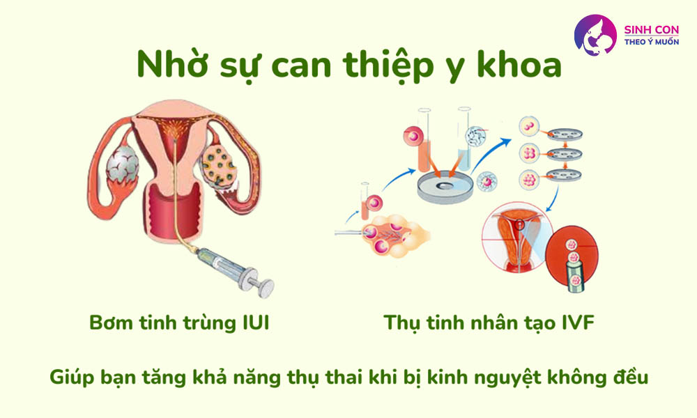 Cách thụ thai nhờ can thiệp y tế cho chị em có kinh nguyệt không đều